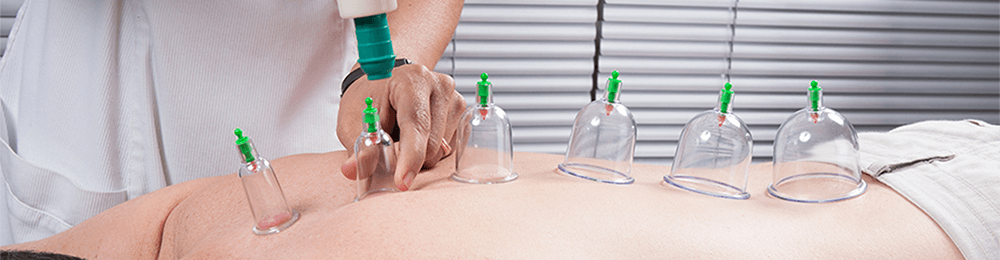 Sports Dry Cupping Course